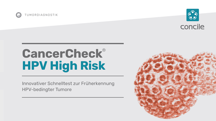 Innovativer Schnelltest erkennt HPV-bedingte Karzinome direkt in der Praxis
